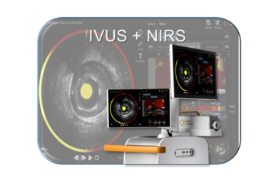 IVUS+NIRS